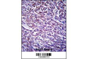 XIRP1 Antibody immunohistochemistry analysis in formalin fixed and paraffin embedded human heart tissue followed by peroxidase conjugation of the secondary antibody and DAB staining. (XIRP1 抗体  (C-Term))