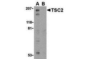 Western Blotting (WB) image for anti-Tuberous Sclerosis 2 (TSC2) (C-Term) antibody (ABIN1030781) (Tuberin 抗体  (C-Term))