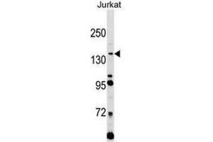Western blot analysis in Jurkat cell line lysates (35ug/lane) using CD171 / L1CAM Antibody . (L1CAM 抗体  (C-Term))
