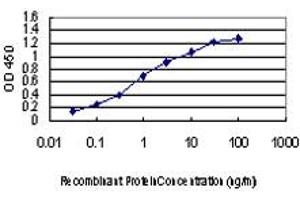 Detection limit for recombinant GST tagged IRAK2 is approximately 0. (IRAK2 抗体  (AA 111-210))