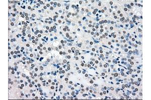 Immunohistochemical staining of paraffin-embedded pancreas tissue using anti-BRAFmouse monoclonal antibody. (BRAF 抗体)