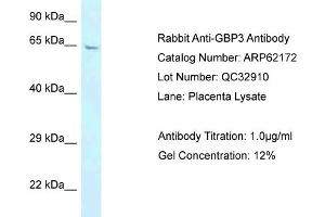 Western Blotting (WB) image for anti-Guanylate Binding Protein 3 (GBP3) (N-Term) antibody (ABIN2789048) (GBP3 抗体  (N-Term))