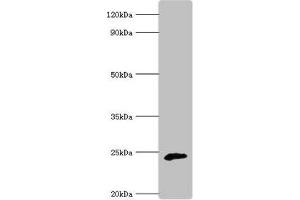 Western blot All lanes: Ubiquinone biosynthesis protein COQ7 homolog antibody at 6 μg/mL + Rat heart tissue Secondary Goat polyclonal to rabbit IgG at 1/10000 dilution Predicted band size: 25, 21 kDa Observed band size: 25 kDa (Coq7 抗体  (AA 37-217))