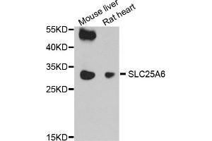 Western blot analysis of extract of mouse liver and rat heart cells, using SLC25A6 antibody. (SLC25A6 抗体)