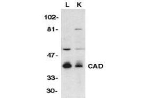 Western blot analysis of CAD in mouse lung (L) and kidney (K) tissue lysates with AP30175PU-N CAD antibody at 1/500 dilution. (DFFB 抗体  (C-Term))