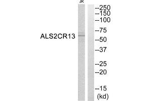 Western Blotting (WB) image for anti-Family with Sequence Similarity 117, Member B (FAM117B) (C-Term) antibody (ABIN1850761) (FAM117B 抗体  (C-Term))