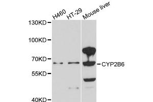 Western blot analysis of extracts of various cell lines, using CYP2B6 antibody. (CYP2B6 抗体)