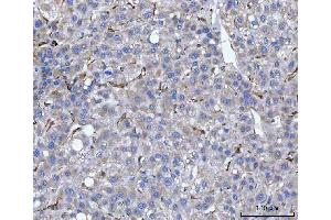 IHC analysis of Hsp47/SERPINH1 using anti-Hsp47/SERPINH1 antibody (ABIN3043331). (SERPINH1 抗体  (AA 247-418))