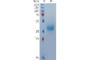Human BCMA(22-54) Protein, mFc Tag on SDS-PAGE under reducing condition.