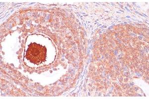 Immunohistochemistry of paraffin-embedded Rat ovary using CDC20 Polyclonal Antibody at dilution of 1:100 (40x lens). (CDC20 抗体)