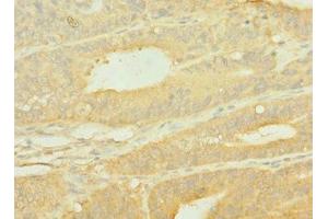 Immunohistochemistry (IHC) image for anti-Solute Carrier Family 1 (Glial High Affinity Glutamate Transporter), Member 2 (SLC1A2) (AA 306-348) antibody (ABIN7156048)
