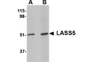 Western Blotting (WB) image for anti-LAG1 Homolog, Ceramide Synthase 5 (LASS5) (N-Term) antibody (ABIN1031694) (LASS5 抗体  (N-Term))