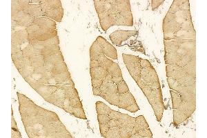 ST7 Mouse Monoclonal Antibody at 1/100 staining rat muscle tissue by IHC-P. (ST7 抗体)