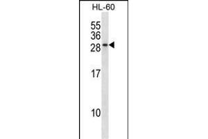 RAB15 Antibody (Center) (ABIN1537730 and ABIN2848465) western blot analysis in HL-60 cell line lysates (35 μg/lane). (RAB15 抗体  (AA 105-133))