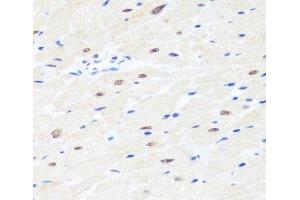 Immunohistochemistry of paraffin-embedded Rat heart using BRMS1 Polyclonal Antibody at dilution of 1:100 (40x lens). (BRMS1 抗体)