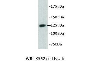 Image no. 1 for anti-tyrosine Kinase with Immunoglobulin-Like and EGF-Like Domains 1 (TIE1) antibody (ABIN1112934) (TIE1 抗体)