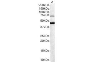 Western Blotting (WB) image for anti-Forkhead Box G1 (FOXG1) (C-Term) antibody (ABIN2465212) (FOXG1 抗体  (C-Term))