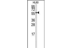 Western blot analysis of anti-CYP4Z1 Antibody (N-term) (ABIN392370 and ABIN2842006) in HL60 cell line lysates (35 μg/lane).