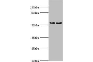 Western blot All lanes: Transcription factor EB antibody at 3 μg/mL Lane 1: Jurkat whole cell lysate Lane 2: Mouse brain tissue Secondary Goat polyclonal to rabbit IgG at 1/10000 dilution Predicted band size: 53, 44 kDa Observed band size: 53 kDa (TFEB 抗体  (AA 1-220))