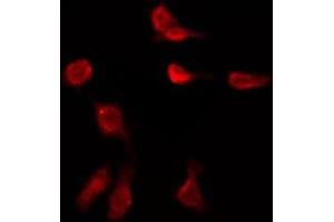 ABIN6276014 staining HeLa by IF/ICC. (GPR149 抗体  (Internal Region))