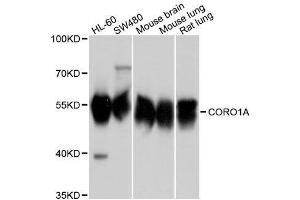 Western blot analysis of extracts of various cell lines, using CORO1A antibody. (Coronin 1a 抗体  (AA 362-461))