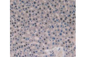IHC-P analysis of liver tissue, with DAB staining. (Superoxide dismutase copper chaperone 抗体  (AA 27-268))