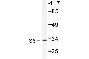 Image no. 1 for anti-Ribosomal Protein S6 (RPS6) antibody (ABIN272077) (RPS6 抗体)