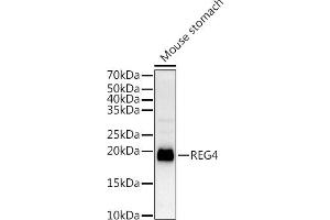 Western blot analysis of extracts of Mouse stomach, using REG4 antibody (ABIN6132619, ABIN6146859, ABIN6146860 and ABIN6217007) at 1:1000 dilution. (REG4 抗体  (AA 23-158))