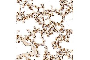 Immunohistochemistry (Paraffin-embedded Sections) (IHC (p)) image for anti-Src Homology 2 Domain Containing F (SHF) antibody (ABIN7075710)