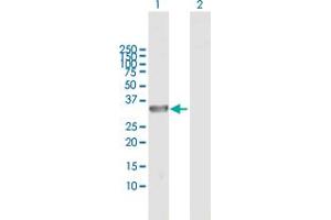 Western Blot analysis of DCUN1D3 expression in transfected 293T cell line by DCUN1D3 MaxPab polyclonal antibody. (DCUN1D3 抗体  (AA 1-304))