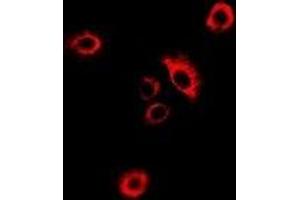 Immunofluorescent analysis of GlyRS staining in MCF7 cells. (GlyRS 抗体)