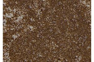 ABIN6261807 and ABIN6277494 at 1/100 staining Mouse spleen tissue by IHC-P. (FOXP1 抗体  (C-Term))