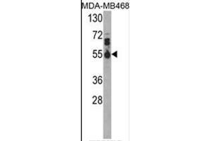 Western blot analysis of IL17RB Antibody (Center) in MDA-MB468 cell line lysates (35ug/lane). (IL17 Receptor B 抗体  (Middle Region))