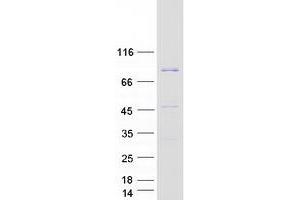 Validation with Western Blot (EEF1D Protein (Transcript Variant 5) (Myc-DYKDDDDK Tag))