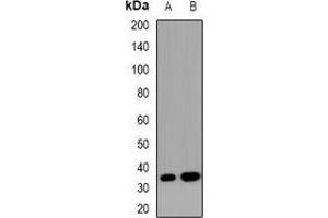 Western blot analysis of SOCS2 expression in HEK293T (A), Hela (B) whole cell lysates. (SOCS2 抗体)