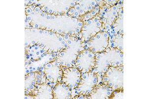 Immunohistochemistry of paraffin-embedded mouse kidney using MAPT antibody (ABIN5970456) at dilution of 1/100 (40x lens). (MAPT 抗体)
