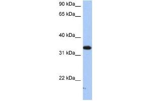 Western Blotting (WB) image for anti-Sulfotransferase Family, Cytosolic, 6B, Member 1 (SULT6B1) antibody (ABIN2459206)