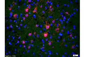 Formalin-fixed and paraffin embedded rat brain labeled with Rabbit Anti CDC40 Polyclonal Antibody, Unconjugated used at 1:200 dilution for 40 minutes at 37°C. (CDC40 抗体  (AA 481-579))