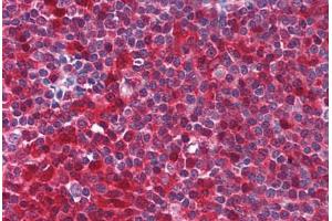 Human Tonsil (formalin-fixed, paraffin-embedded) stained with PYCARD antibody ABIN213971 at 5 ug/ml followed by biotinylated goat anti-rabbit IgG secondary antibody ABIN481713, alkaline phosphatase-streptavidin and chromogen. (PYCARD 抗体  (AA 182-195))