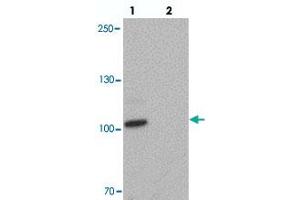 Western blot analysis of CCNT1 in rat brain tissue with CCNT1 polyclonal antibody  at 1 ug/mL in (lane 1) the absence and (lane 2) the presence of blocking peptide. (Cyclin T1 抗体  (C-Term))