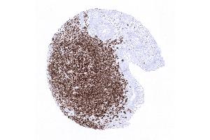 Appendix mucosa (Recombinant CD20 抗体)