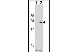 Western blot analysis of PTP4A1 (arrow) using rabbit polyclonal PTP4A1 Antibody (C-term) (ABIN1536716 and ABIN2848589). (PTP4A1 抗体  (C-Term))