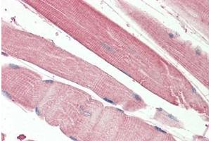 Human Skeletal Muscle: Formalin-Fixed, Paraffin-Embedded (FFPE) (THNSL2 抗体  (AA 192-204))