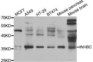 Western blot analysis of extracts of various cell lines, using INHBC antibody. (INHBC 抗体)