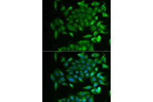 Immunofluorescence analysis of MCF-7 cell using RBP2 antibody. (RBP2 抗体)