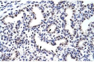 Rabbit Anti-WNT2B Antibody Catalog Number: ARP41254 Paraffin Embedded Tissue: Human Lung Cellular Data: Alveolar cells Antibody Concentration: 4. (WNT2B 抗体  (Middle Region))