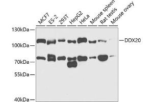 Western blot analysis of extracts of various cell lines, using DDX20 antibody (ABIN6130250, ABIN6139482, ABIN6139483 and ABIN6221507) at 1:1000 dilution. (DDX20 抗体  (AA 25-280))