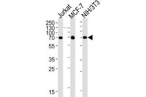 Western Blotting (WB) image for anti-Ribosomal Protein S6 Kinase, 70kDa, Polypeptide 2 (RPS6KB2) antibody (ABIN2995324) (RPS6KB2 抗体)