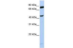WB Suggested Anti-SMYD3 Antibody Titration:  0. (SMYD3 抗体  (C-Term))