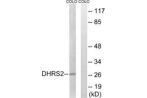 Western blot analysis of extracts from COLO cells, using DHRS2 antibody. (DHRS2 抗体  (Internal Region))